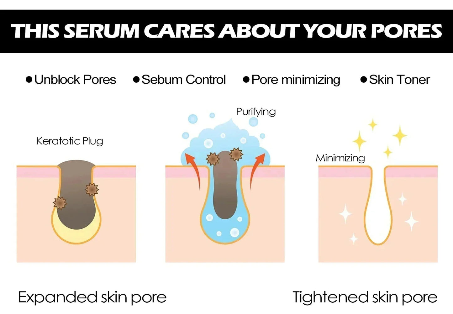 Sérum Reductor de Poros con Ácido Láctico